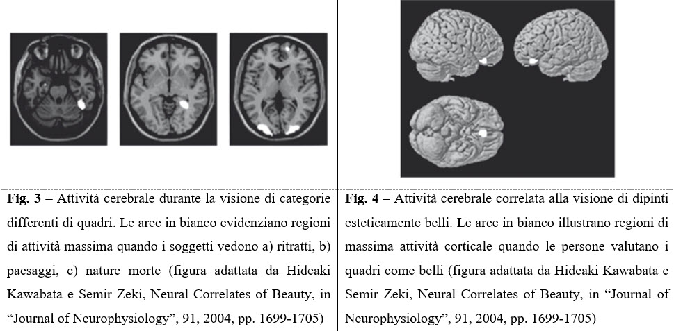 Cos'è la Neuroestetica?