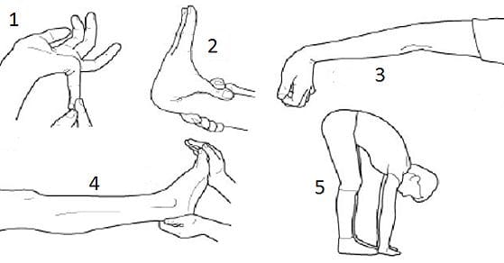 Tachicardia posturale nella SINDROME DI EHLERS DANLOS