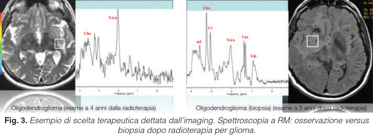 Costo-beneficio dell'impiego di tecnologie diagnostiche d'eccellenza