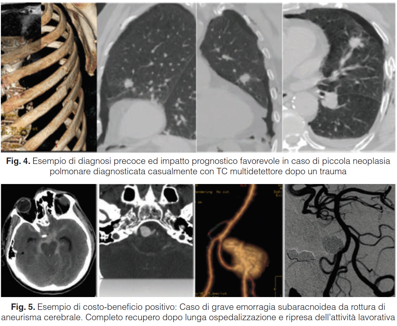 Costo-beneficio dell'impiego di tecnologie diagnostiche d'eccellenza